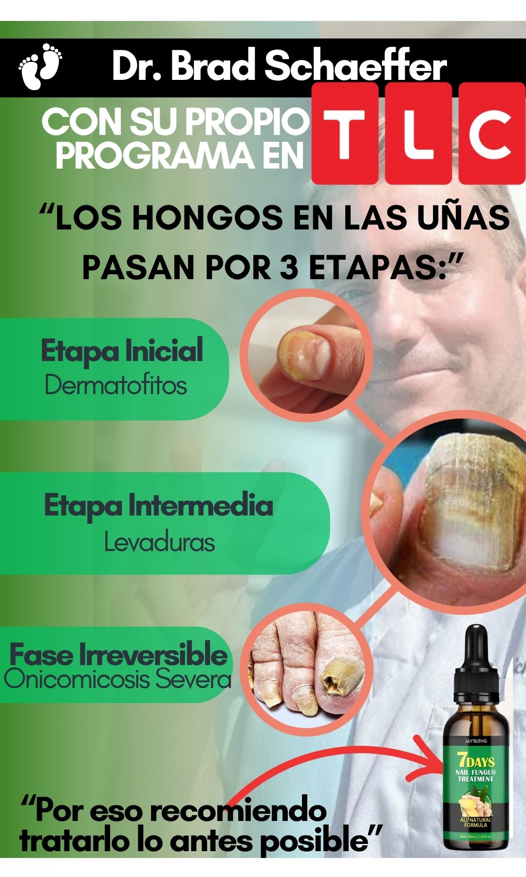 Serum Antihongos con Jojoba - Recupera tus uñas desde el dia #7