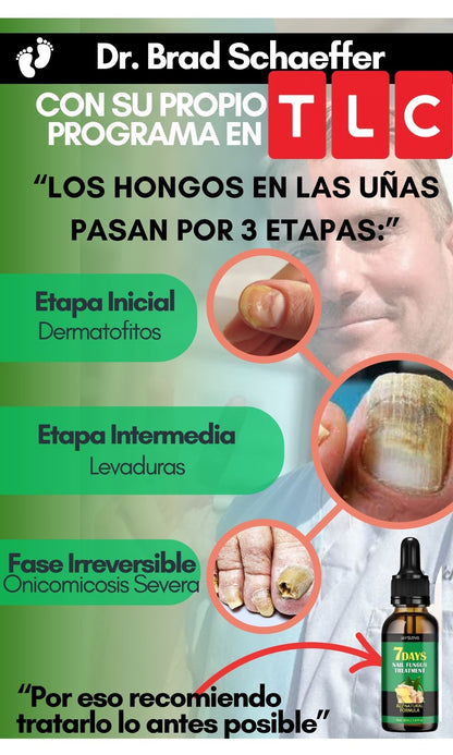 Serum Antihongos con Jojoba - Recupera tus uñas desde el dia #7