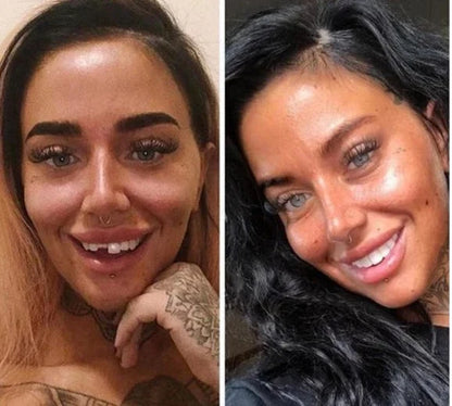 Carillas Dentales Premium ® Snap-On Smile - Perfecto para muecos & dientes amarillos