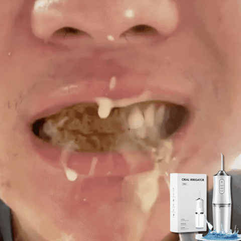 Irrigador Dental Inteligente, transforma tu rutina bucal 🔥Solo por hoy 50% de Descuento🔥